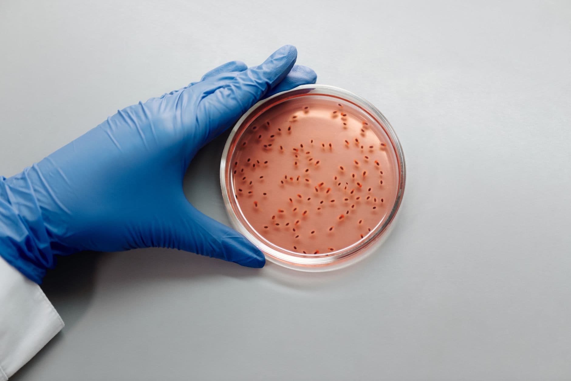 Houston area accounts for 90 of Texas cyclospora cases