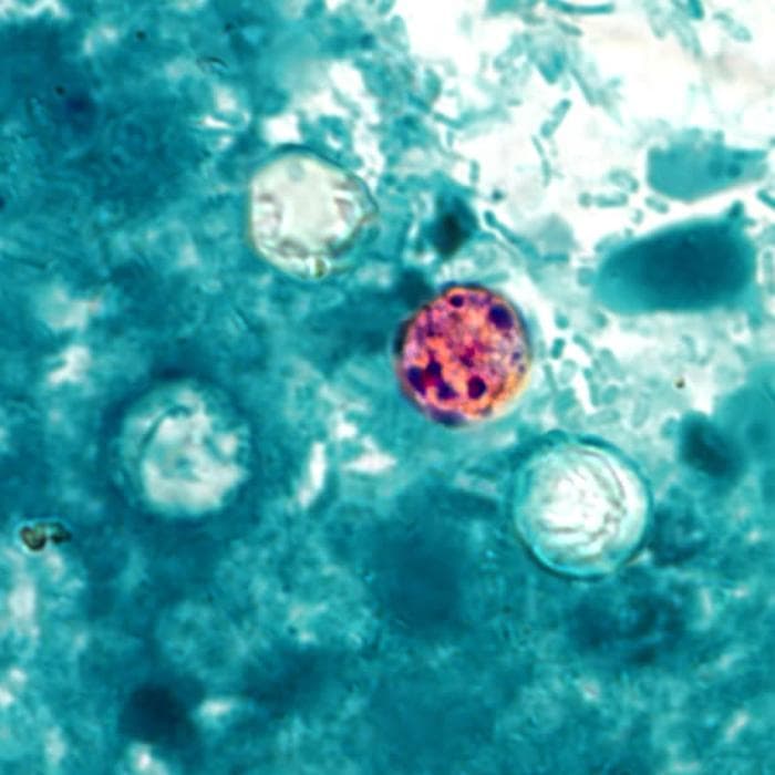 Cyclospora cayetanensis — Wikimedia Commons